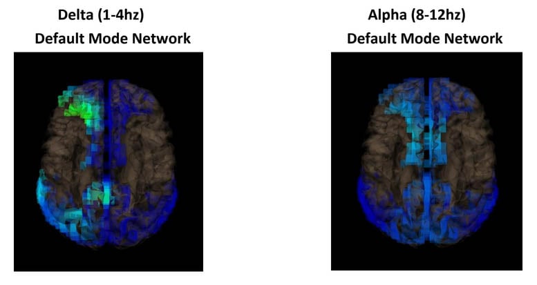Changes in the DMN during the Soma meditation